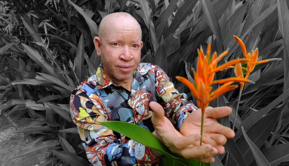 From Taxi Driver to Empowerment: My Journey as an Albinism Advocate